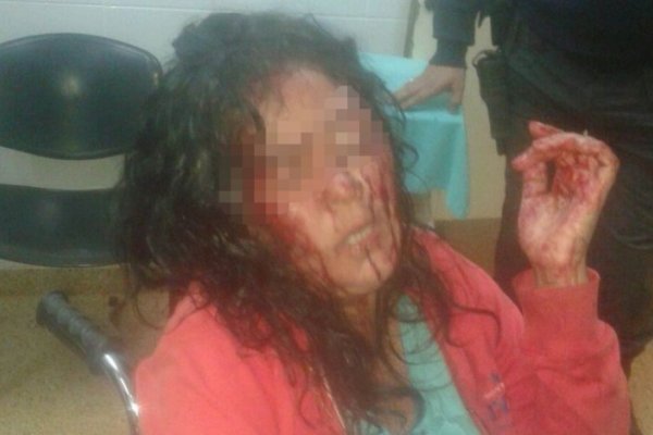 Virasoro: Rescataron a una mujer golpeada por su pareja