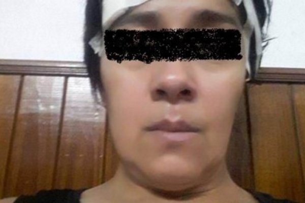 Brindan custodia policial a mujer agredida por su ex en Año Nuevo