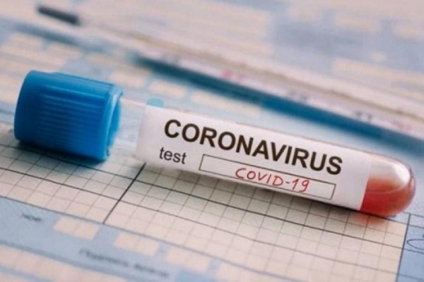 Corrientes: Se registraron 13 nuevos contagios de coronavirus en Paso de los Libres