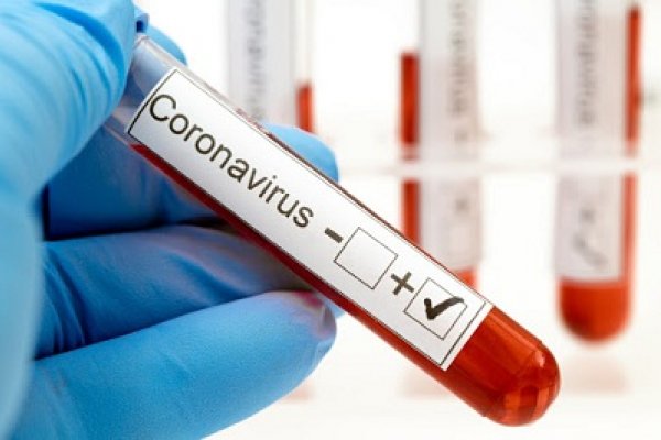 Corrientes: Dos casos nuevos de Coronavirus en Capital