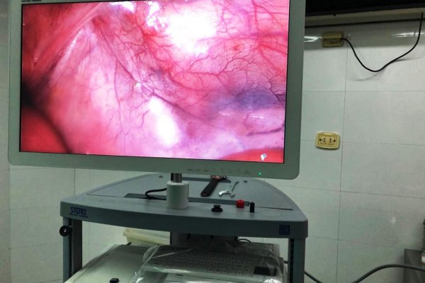 Con nuevo equipamiento, el hospital Llano aumenta su promedio de cirugías