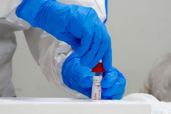 Corrientes registró 88 nuevos casos de Coronavirus: En Capital 53 y 35 en el Interior