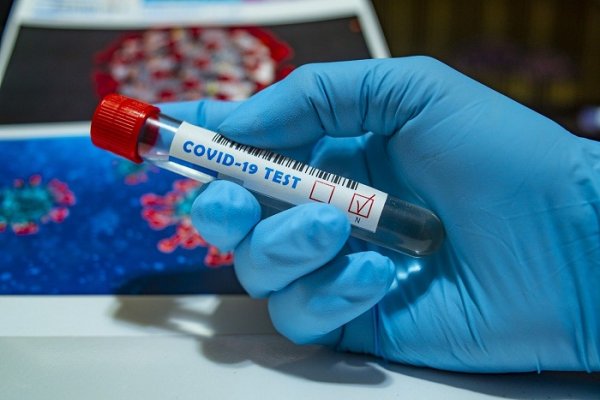 Coronavirus: Detectaron 149 nuevos contagios y pasó los 14.000 casos en Corrientes