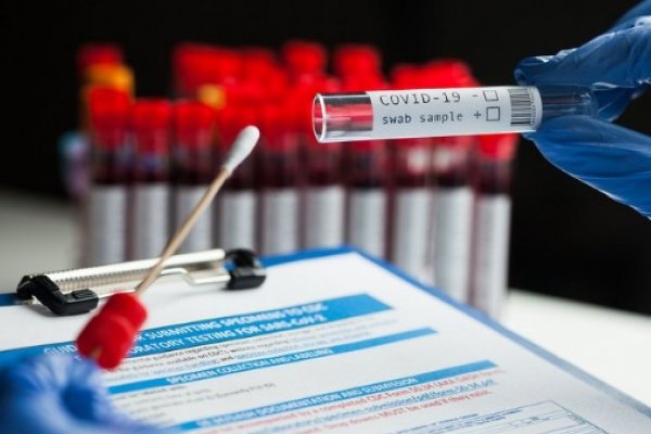 Coronavirus en Corrientes: Se detectaron 217 nuevos contagios