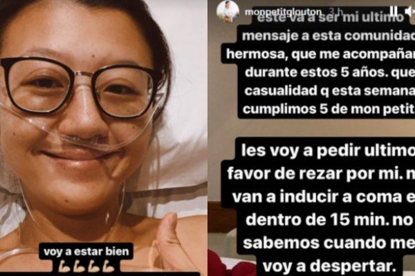 La cocinera del programa de Florencia Peña fue inducida a un coma farmacológico