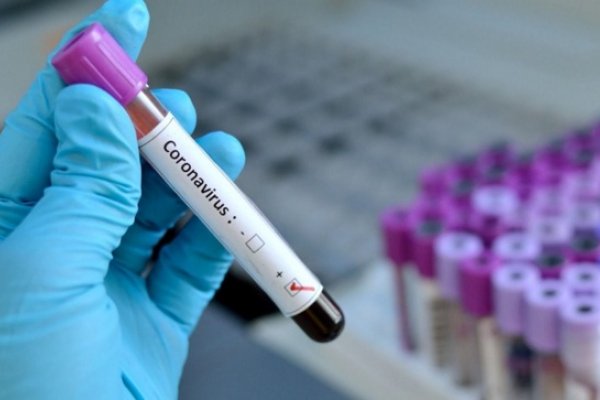 Otro récord: Corrientes sumó 325 contagios de Coronavirus