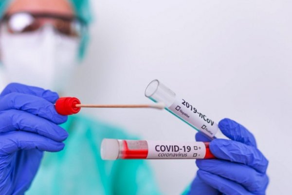 Coronavirus: Detectaron 315 casos nuevos en Corrientes