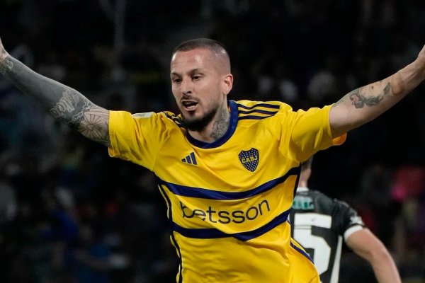 Benedetto habló de su cambio de look: 