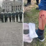 Las fuerzas de Seguridad reprimieron con balazos de goma a una Diputada y a manifestantes frente al Congreso