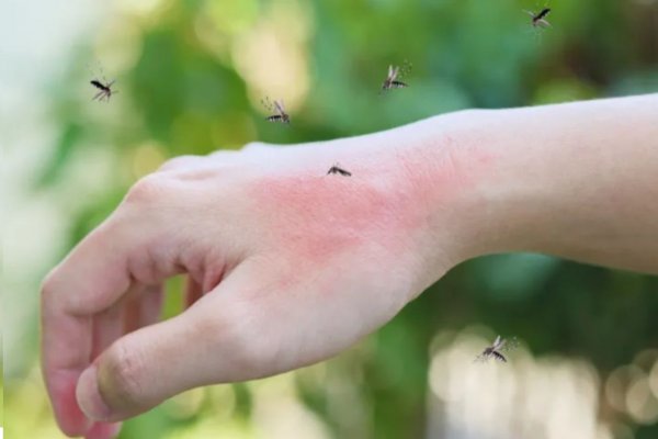 OJO CON LA LLUVIA! El NEA superó los 100 casos de Dengue