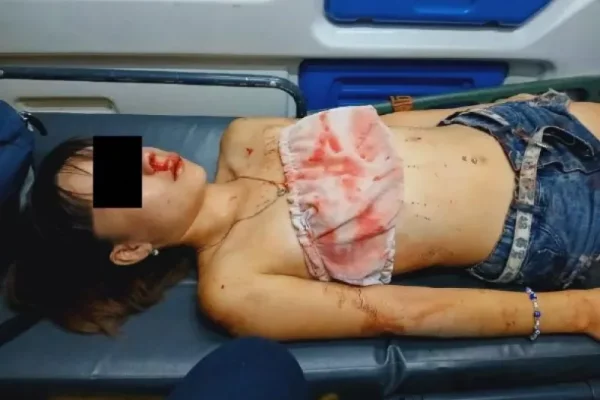 Corrientes: una menor fue golpeada brutalmente por una patota